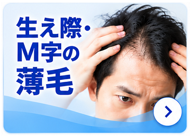 生え際の薄毛から探す