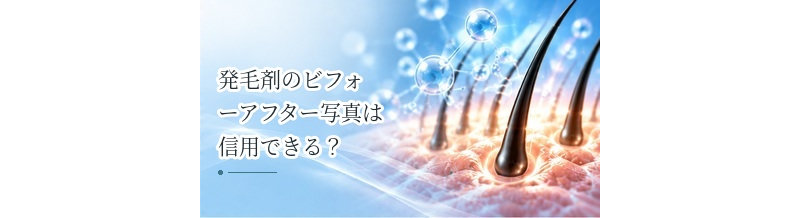 発毛剤のビフォーアフター写真は信用できる？写真を見るときの注意点