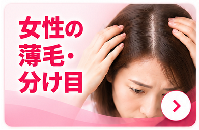 女性の薄毛から探す