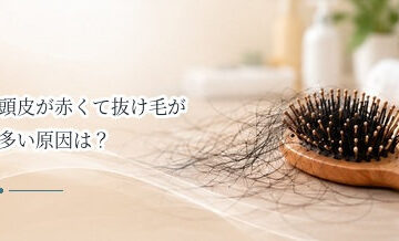 頭皮が赤くて抜け毛が多い原因は？炎症があるときの受診目安