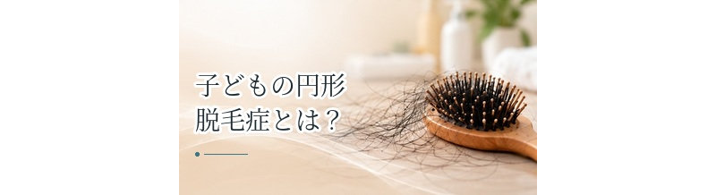 子どもの円形脱毛症とは？原因・治療・学校生活での対応を解説