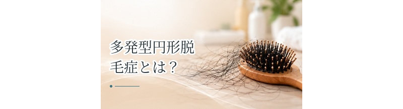 多発型円形脱毛症とは？複数の脱毛斑ができる症状と治療