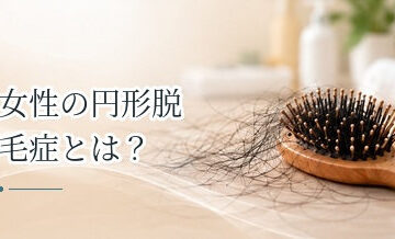 女性の円形脱毛症とは？症状・治療と髪をカバーする方法