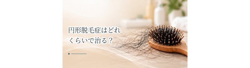 円形脱毛症はどれくらいで治る？発毛までの経過と期間の目安