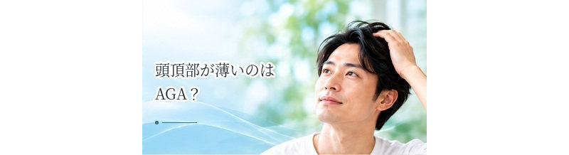 頭頂部が薄いのはAGA？つむじ周辺の薄毛の原因と対策