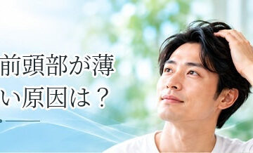 前頭部が薄い原因は？AGAによる薄毛とその他の原因を解説