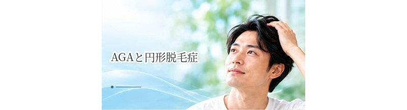 AGAと円形脱毛症の違いは？症状・原因・治療方法を比較