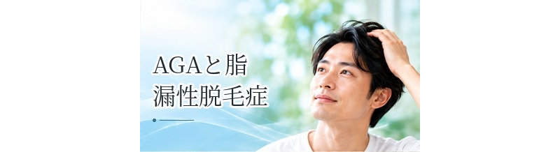 AGAと脂漏性脱毛症の違いは？頭皮症状がある場合の見分け方