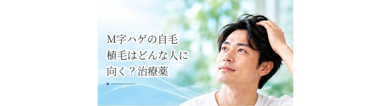 M字ハゲの自毛植毛はどんな人に向く？治療薬との違いを解説
