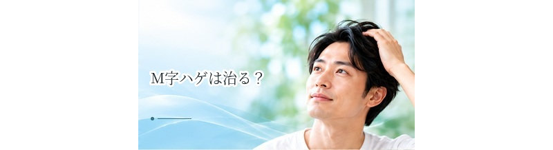 M字ハゲは治る？AGA治療・発毛剤・植毛など対策を解説