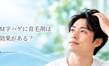 M字ハゲに育毛剤は効果がある？AGAが疑われる場合の選択肢