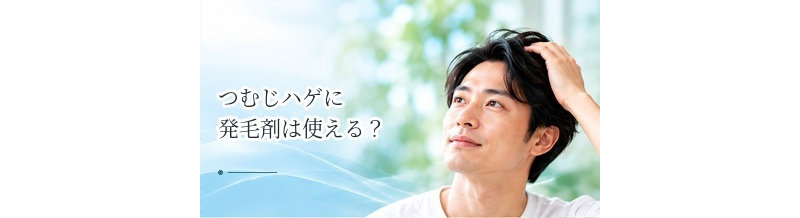 つむじハゲに発毛剤は使える？頭頂部へ使用するときのポイント