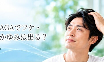 AGAでフケ・かゆみは出る？頭皮トラブルがある場合の注意点