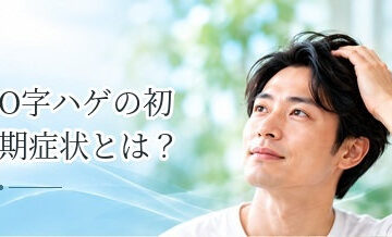O字ハゲの初期症状とは？頭頂部の変化を確認する方法