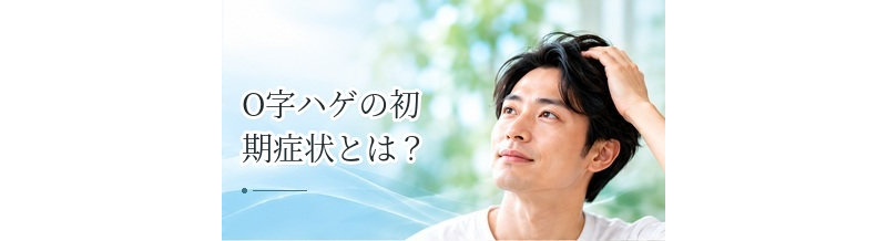 O字ハゲの初期症状とは？頭頂部の変化を確認する方法