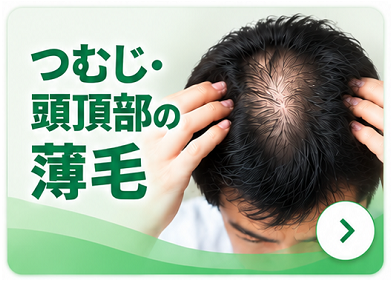 頭頂部の薄毛から探す