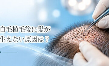 自毛植毛後に髪が生えない原因は？定着・発毛を確認するタイミング