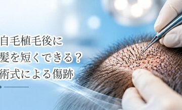 自毛植毛後に髪を短くできる？術式による傷跡の違いを解説