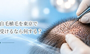 自毛植毛を東京で受けるなら何を比較する？クリニック選びのポイント