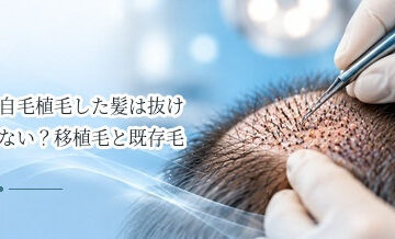 自毛植毛した髪は抜けない？移植毛と既存毛の違いを解説