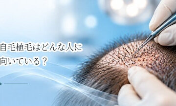 自毛植毛はどんな人に向いている？向いていない人との違いを解説