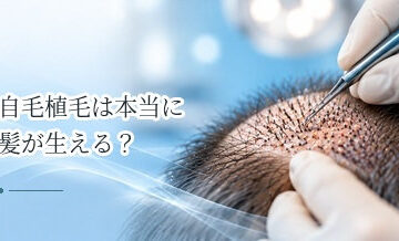 自毛植毛は本当に髪が生える？定着後の仕組みと期待できる効果