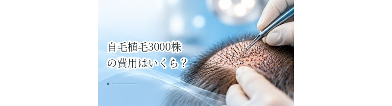 自毛植毛3000株の費用はいくら？大量移植の料金と注意点