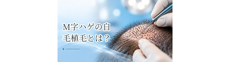 M字ハゲの自毛植毛とは？必要株数・費用・デザインのポイント