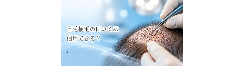 自毛植毛の口コミは信用できる？症例写真・評判を見るときの注意点