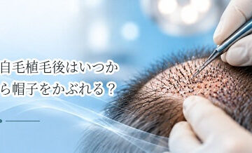 自毛植毛後はいつから帽子をかぶれる？移植部を守るポイント