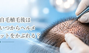自毛植毛後はいつからヘルメットをかぶれる？仕事復帰前の注意点