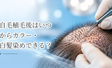 自毛植毛後はいつからカラー・白髪染めできる？頭皮への刺激を解説