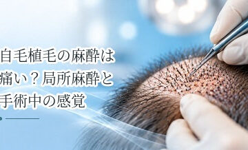 自毛植毛の麻酔は痛い？局所麻酔と手術中の感覚を解説