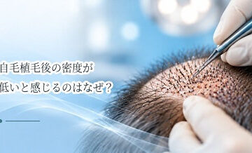 自毛植毛後の密度が低いと感じるのはなぜ？完成前と定着後の見方