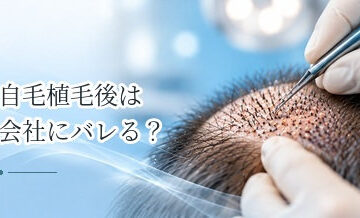 自毛植毛後は会社にバレる？刈り上げ・赤み・かさぶたを隠す方法
