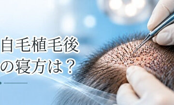 自毛植毛後の寝方は？移植部を守る枕・姿勢のポイント
