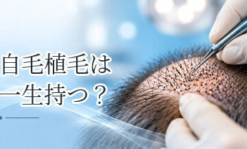 自毛植毛は一生持つ？移植毛の寿命とAGAの進行について解説