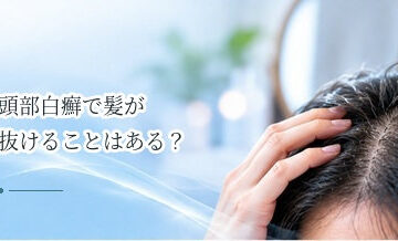 頭部白癬で髪が抜けることはある？脱毛を伴う感染症を解説