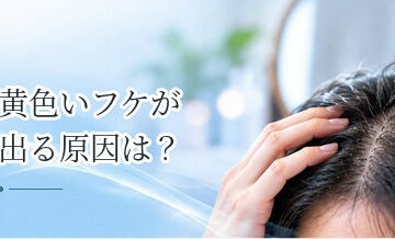 黄色いフケが出る原因は？皮脂・炎症・脂漏性皮膚炎を解説