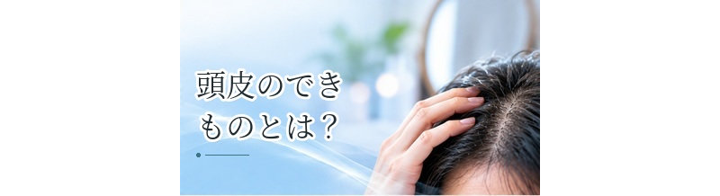 頭皮のできものとは？ニキビ・粉瘤・湿疹など主な原因を解説