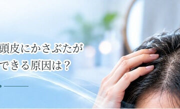 頭皮にかさぶたができる原因は？傷・湿疹・脂漏性皮膚炎などを解説