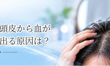頭皮から血が出る原因は？掻き傷・できものなどを確認