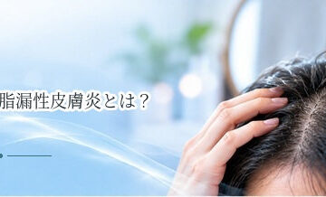 脂漏性皮膚炎とは？頭皮のフケ・赤み・かゆみの原因を解説
