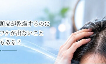 頭皮が乾燥するのにフケが出ないこともある？症状の違いを解説