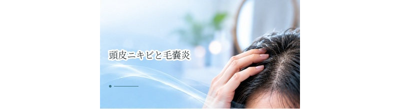 頭皮ニキビと毛嚢炎の違いは？見分け方と対処法を解説