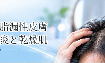 脂漏性皮膚炎と乾燥肌の違いは？フケ・皮脂から見分けるポイント
