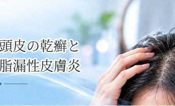 頭皮の乾癬と脂漏性皮膚炎の違いは？症状の特徴を整理