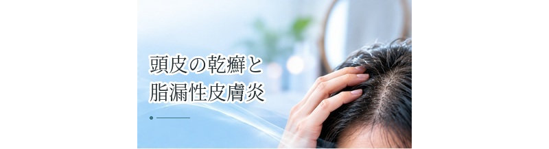 頭皮の乾癬と脂漏性皮膚炎の違いは？症状の特徴を整理