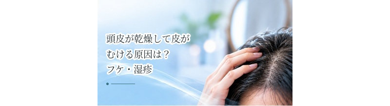 頭皮が乾燥して皮がむける原因は？フケ・湿疹との違いを確認