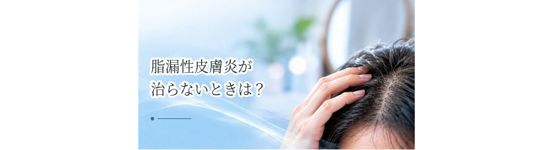 脂漏性皮膚炎が治らないときは？皮膚科で相談したい理由